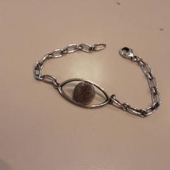 Polsbandjes Alziende oog zilver, amint azt LUMC az iLost segítségével jelentette.