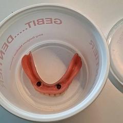 Gebit onder, som rapportert av Ziekenhuis Oost-Limburg ved bruk av iLost