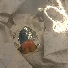 Gebits stukje, jak nahlášeno Ziekenhuis Oost-Limburg pomocí iLost