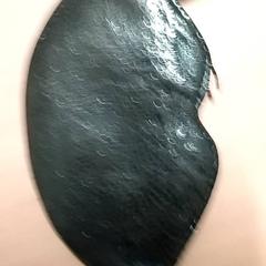 반지, iLost를 사용하여 RET에 보고됨