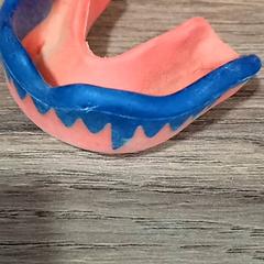 Pierścień na ząbkowanie goutiere, zgłoszono przez CARS HANGARD przy użyciu iLost