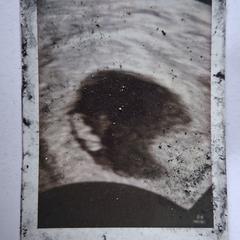 Ecjo foto zwangerschap, ha sido reportado a iLost