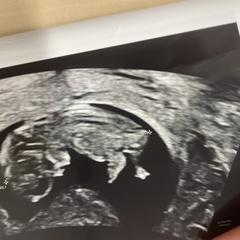 Echo uitdraai, segundo informou a iLost